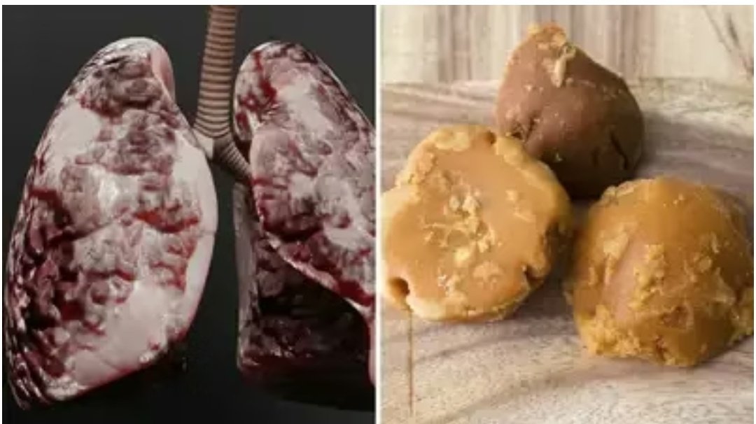 पॉल्यूशन वाली खांसी-हांफना का कारगर उपाय है गुड़, 1 चीज के साथ खाएं, डॉक्टर सलीम जैदी का गंदगी हटाने का तरीका 1 Screenshot 20251030 042734