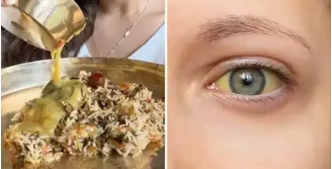 भारत की 57% फीमेल्स में आयरन बहुत कम, ताजा खून बढ़ाने का एक्सपर्ट का देसी नुस्खा, पीला चेहरा होगा लाल 1 Screenshot 20251106 082720