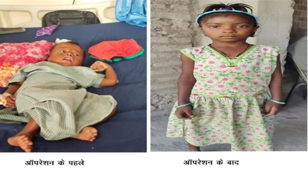 चिरायु योजना बच्चों के लिए बनी वरदान, तीनों बच्चों के चेहरे की लौटी मुस्कान, माता-पिता के जीवन में जगी नई उम्मीद 1 1006 1024x576 rSerAH